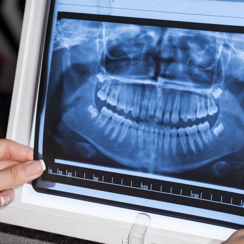 Radiografías Digitales Rinze Dental